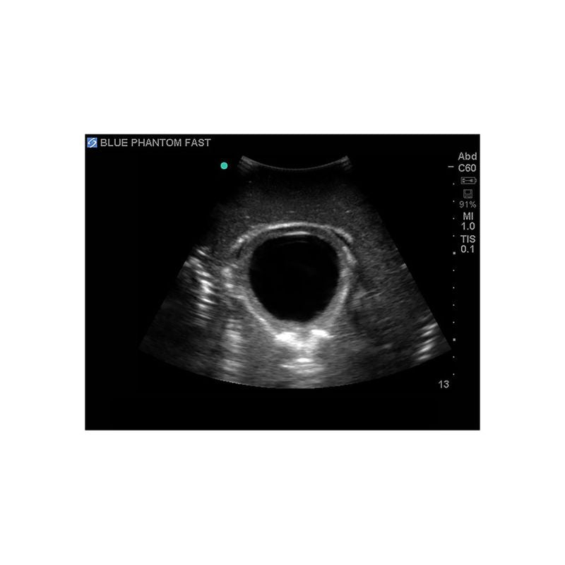 FAST Exam Ultrasound Training Model - Transthoracic & Transesophageal Echo Simulator for Cardiac Sonography Practice (Ideal for Medical Students, Ultrasound Tech Training & Clinical Skills Development)