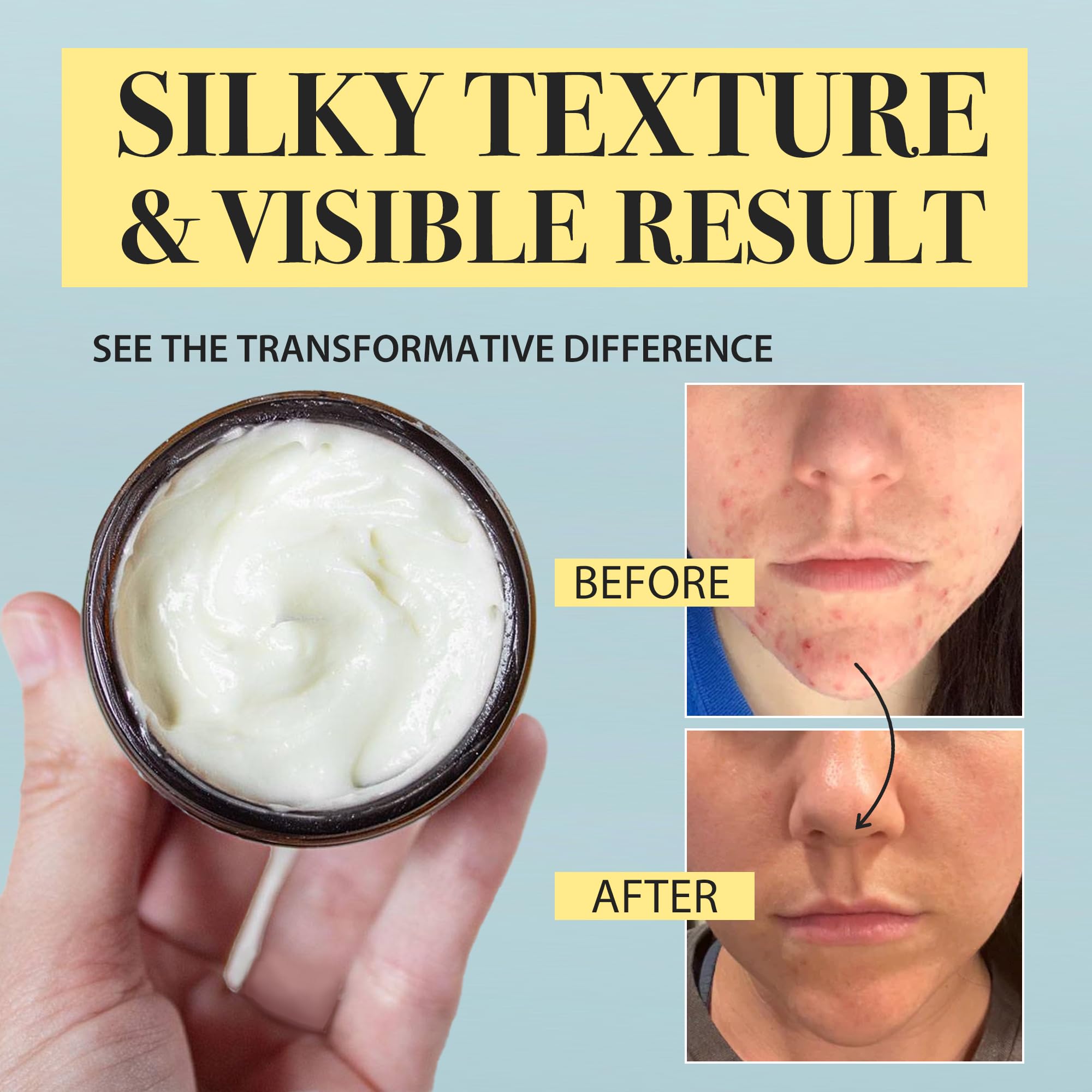 100% Grass-Fed Beef Tallow & Manuka Honey Balm for Face & Body - Organic Moisturizer with Olive Oil for Sensitive Dry Skin Repair - 2 oz - Perfect for Winter Care & Eczema Relief