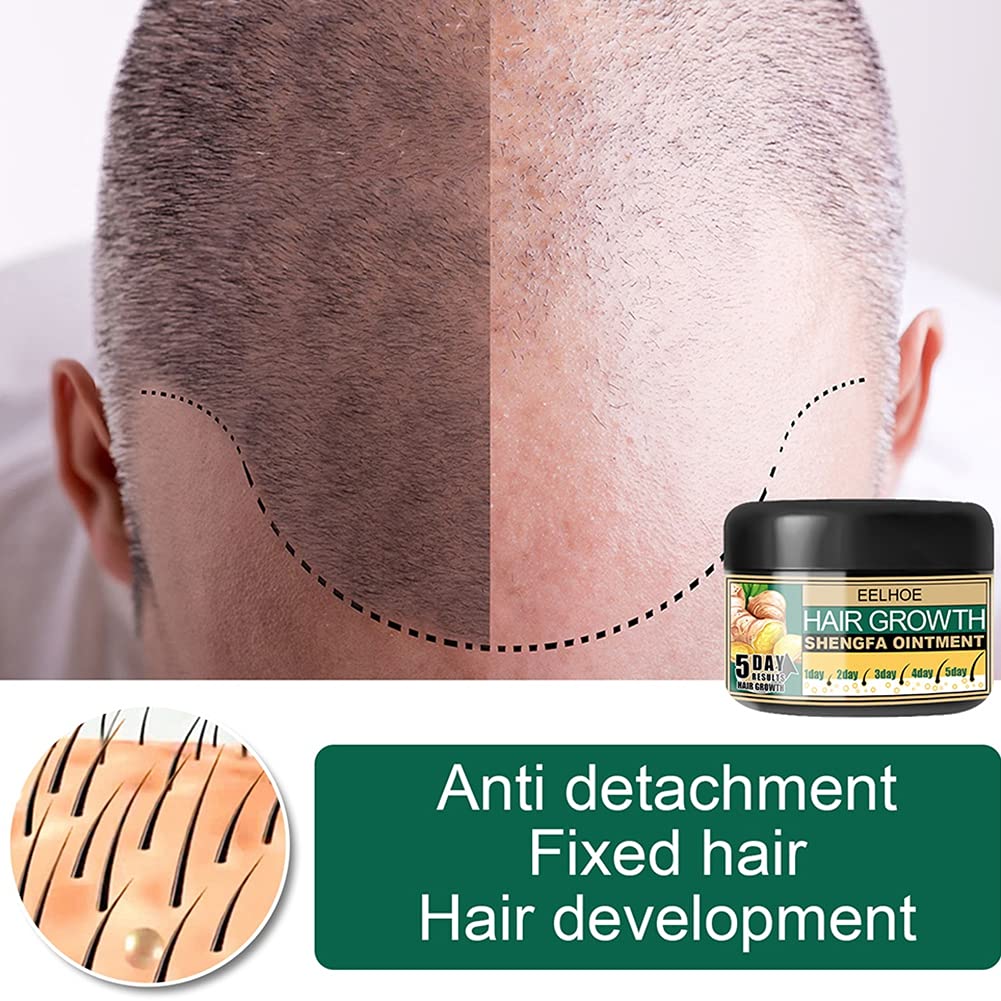 Hair Growth Cream for Bald Spot Treatment - Scalp Moisturizer & Follicle Conditioner for Men & Women - Promotes Hair Regrowth & Scalp Massage - Ideal for Thinning Hair & Daily Hair Care Routine