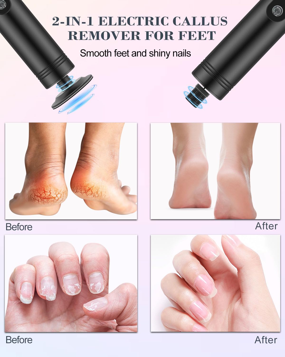 2 in 1 Electric Foot Callus Remover - 9 Speed Adjustable Pedicure Tool with LED Display & 2000mAh Rechargeable Battery - Professional Foot File for Dead Skin Removal - Includes Replaceable Sandpaper Discs (Black) - Perfect for Home Pedicure & Foot Care Routine