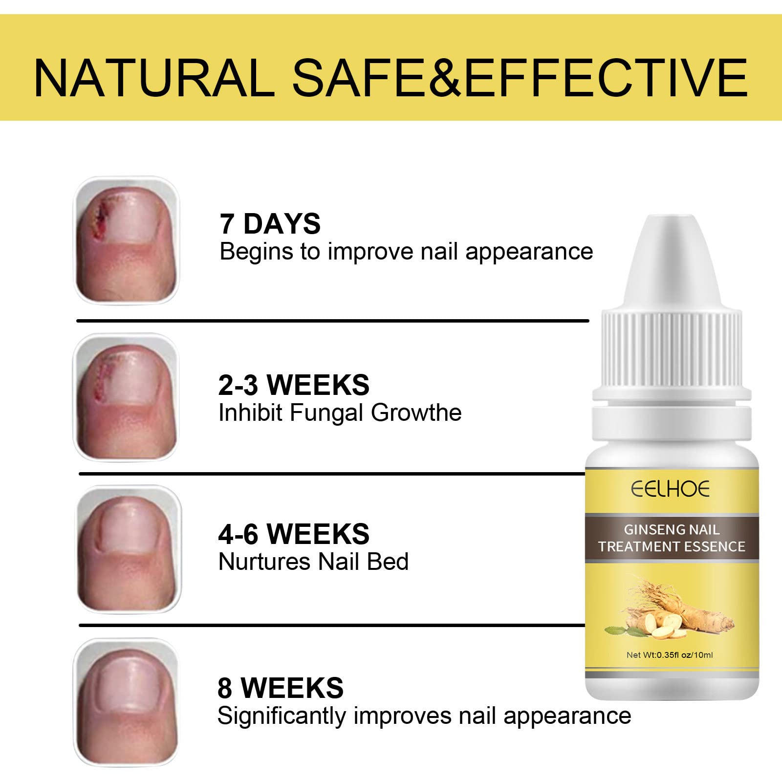 10ml Ginseng Nail Treatment - Herbal Hand & Foot Whitening Cream for Cracked, Rough, Brittle Nails - Natural Nail Care Solution for Toe & Finger Nails - Perfect for Pedicures, Manicures & At-Home Nail Care Routines