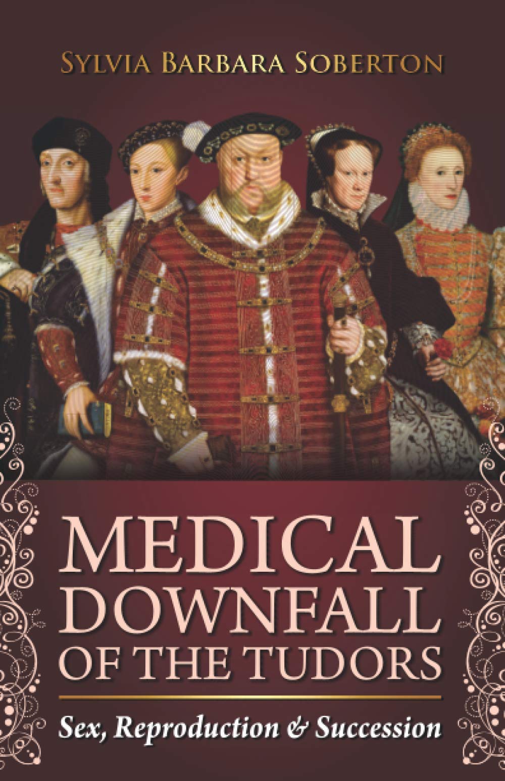 The Medical Downfall of the Tudors: Sex, Reproduction & Royal Succession in Tudor England - Perfect for History Buffs and Tudor Dynasty Enthusiasts
