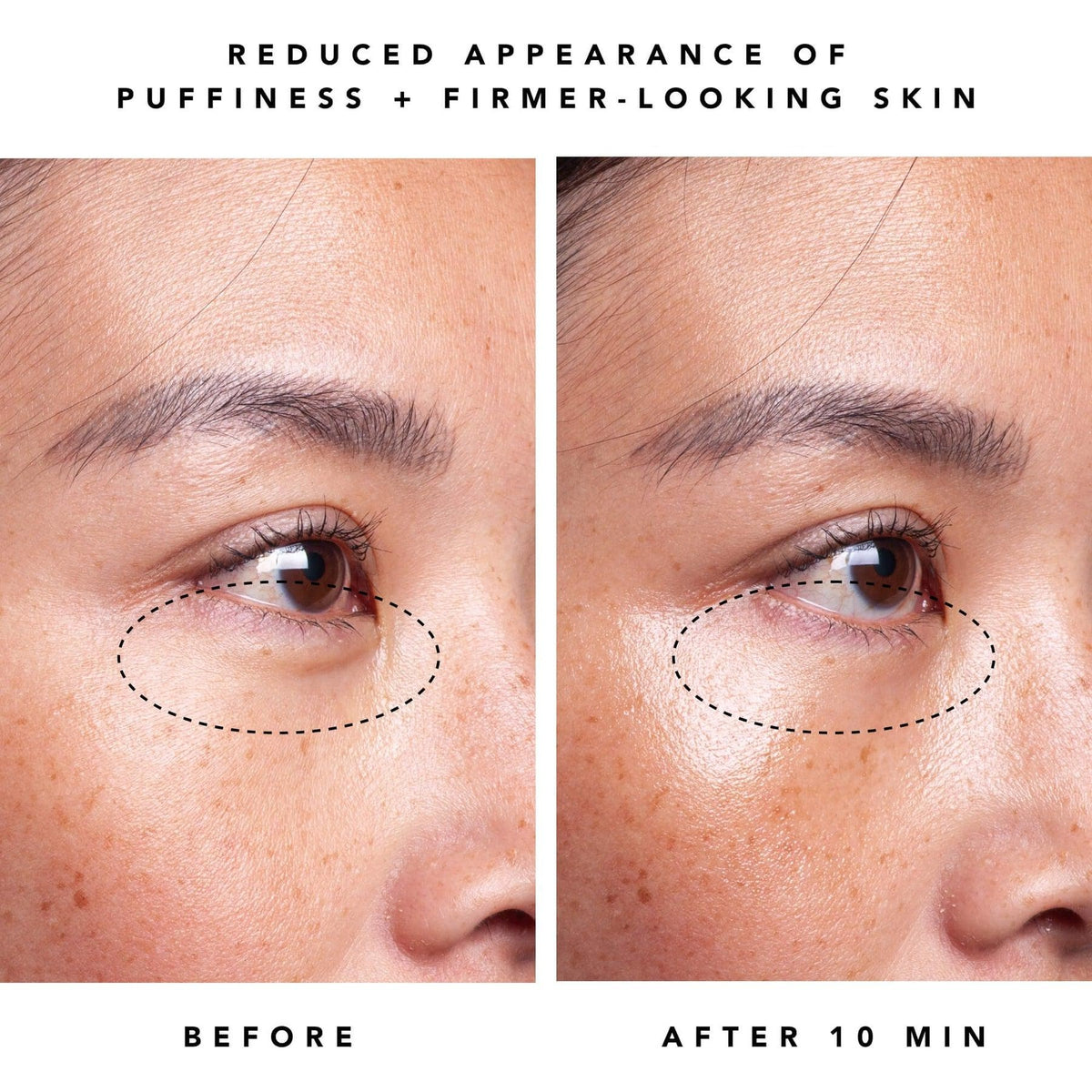 Moon Dew 1% Bakuchiol & Peptides Anti-Aging Eye Cream - Natural Retinol Alternative for Dark Circles & Wrinkles - Perfect for Nighttime Skincare Routine