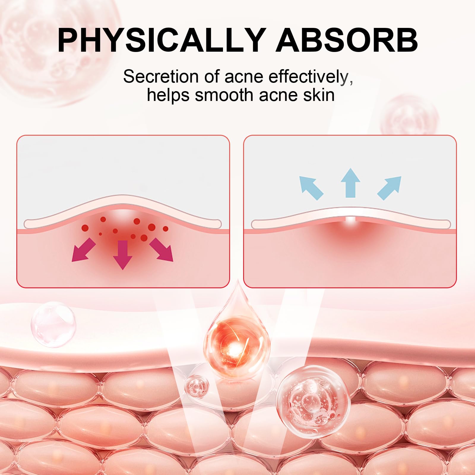 Hydrocolloid Acne Patches for Face - 144 Pcs (108 Day + 36 Night) with Salicylic Acid, Tea Tree & Calendula Oil - Effective Pimple Patches for Zits, Blackheads & Blemish Treatment - Perfect for Overnight Spot Treatment & Daily Acne Care