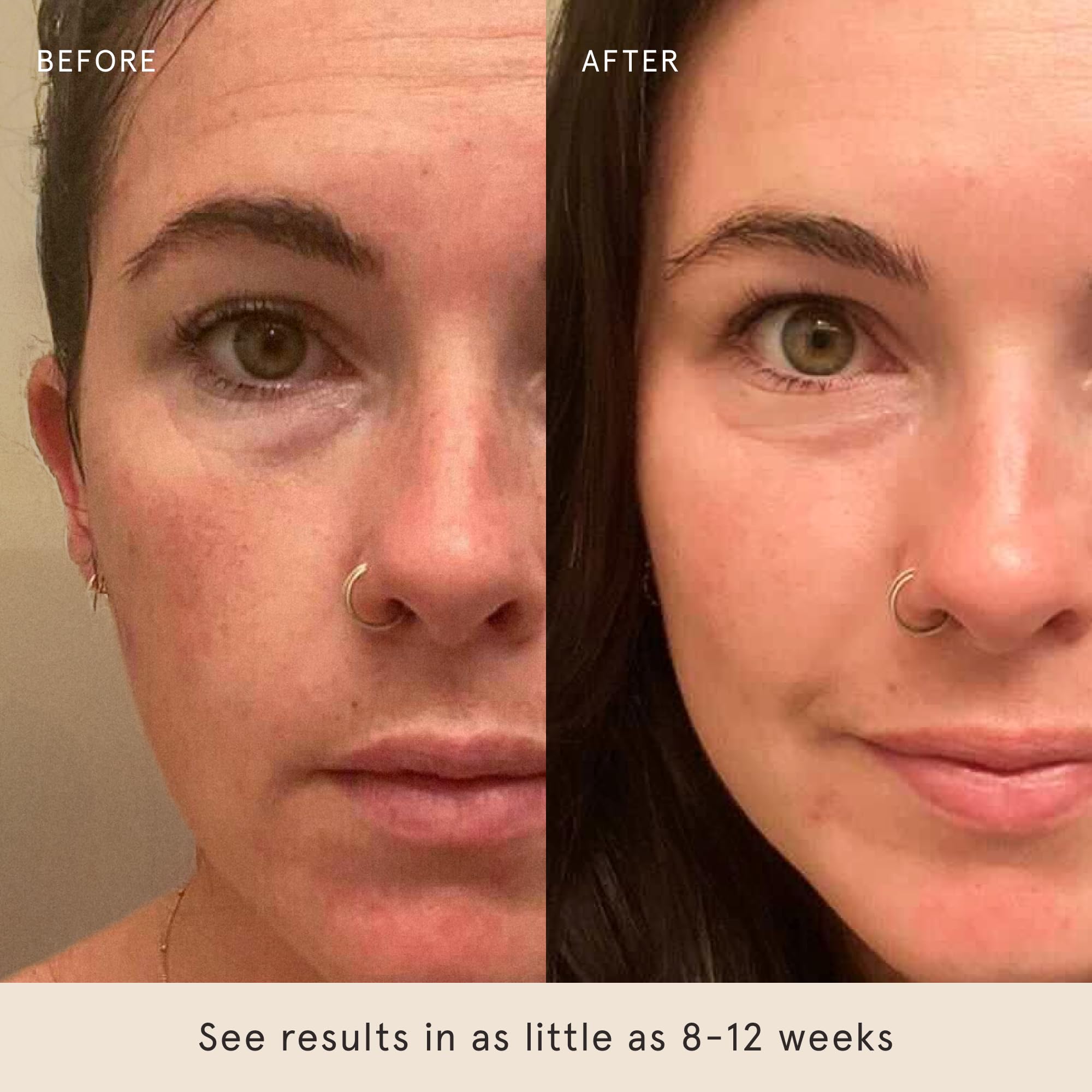 Barefaced Overachiever 30 mL - 10-in-1 Skin Booster Serum with Bakuchiol, Resveratrol & Green Tea Extract | Retinol Alternative for Sensitive Skin | Pregnancy Safe Formula | Hydrates Skin, Minimizes Pores, Reduces Redness & Wrinkles | Perfect for Daily Skincare Routine & Anti-Aging Regimen