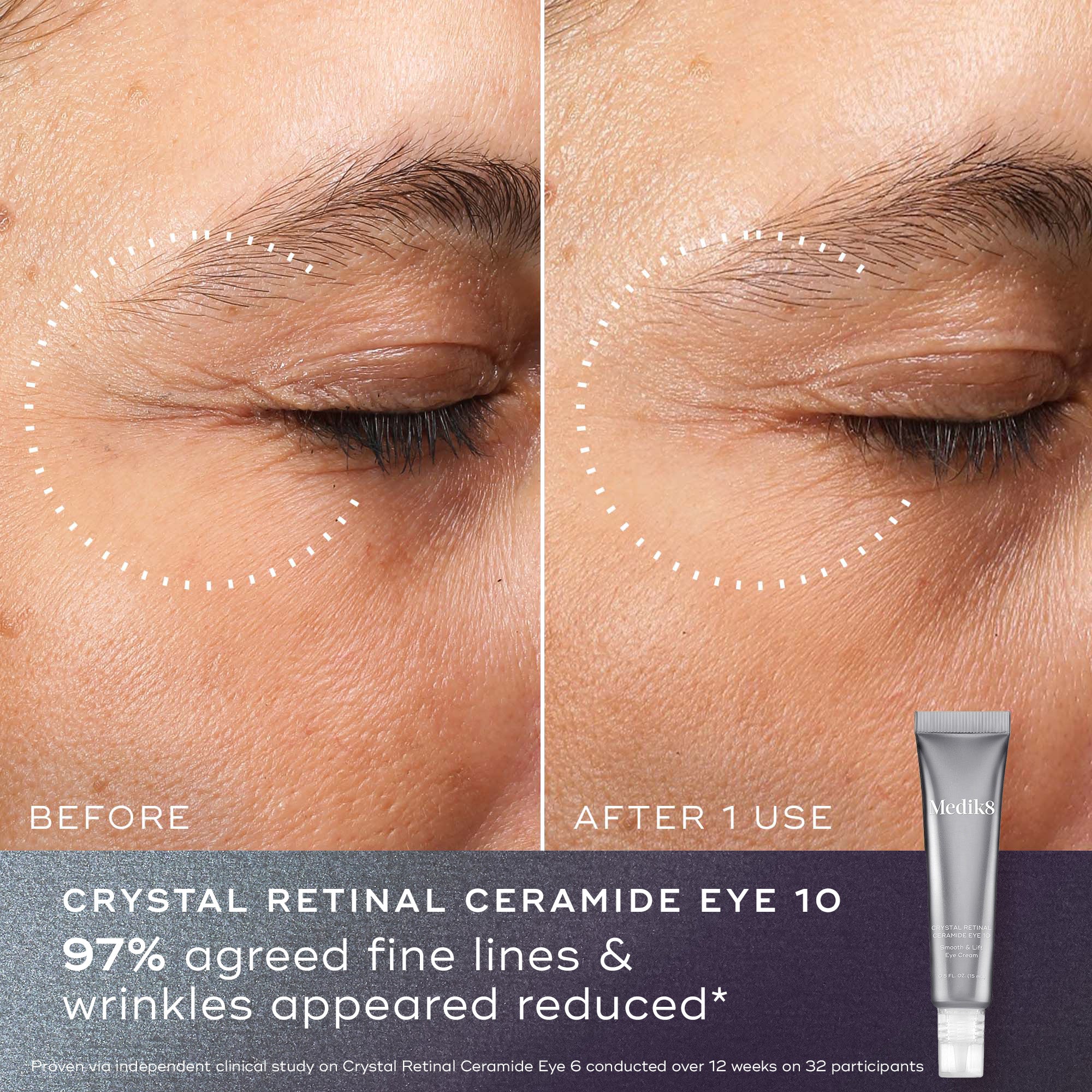 Reduce Wrinkles & Renew Skin with Retinol Cream – Anti-Aging Face Moisturizer for Day & Night Use