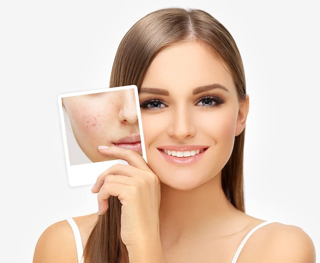 Organic Lemon Peel Powder (100Gm) - Skin Brightening, Dark Circle Treatment, Hair Growth & Glowing Face | For Face Cleanser, Herbal Tea, Teeth Whitening & Cooking | Pure Citrus Limonum (Nimbu) for Pigmentation & Healthy Hair