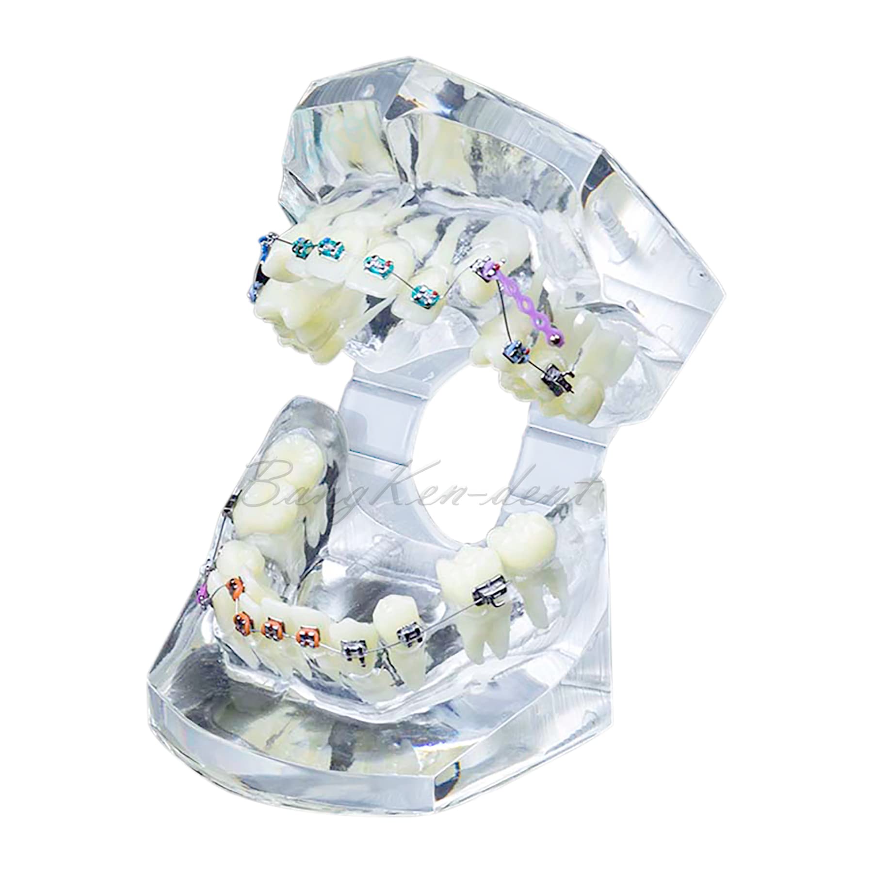 Orthodontic Typodont Dental Model with Braces, Arch Wire, Bracket & Buccal Tube - Premolar Deformity Teaching Demonstration Kit for Dental Students & Professionals (M3005-CLEAR) - Perfect for Dental School Practice, Orthodontic Training & Clinical Demonstrations