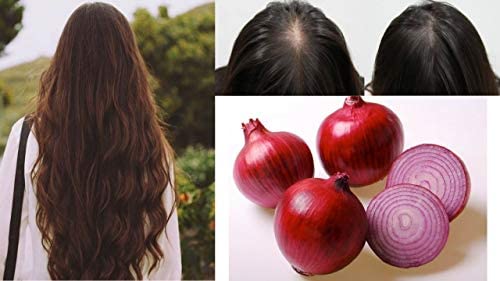 Khadi Rishikesh Herbal Onion Hair Growth Oil - 210ml | Controls Hair Fall, Promotes Silky Long Strong Hair, Reduces Dandruff | Made with Hibiscus, Curry Leaves & Olive Oil | Best Hair Loss Treatment Oil | Daily Use for Hair Growth | Free Rumal Included | Perfect for Men & Women with Thinning Hair or Scalp Issues