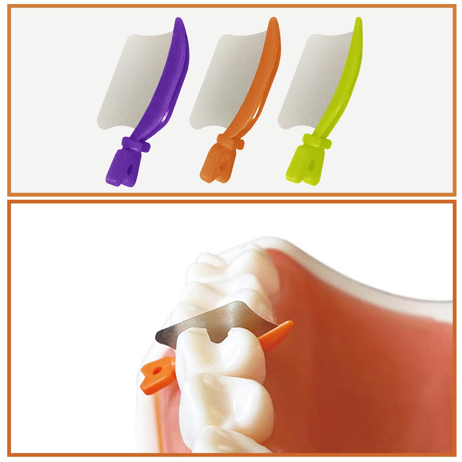 Dental Wedge Knife & Interproximal Plastic Wedges - Orthodontic Matrix Wedges for Teeth with Metal Guard (Purple, Large) - Perfect for Dental Procedures, Teeth Separation & Interproximal Restoration