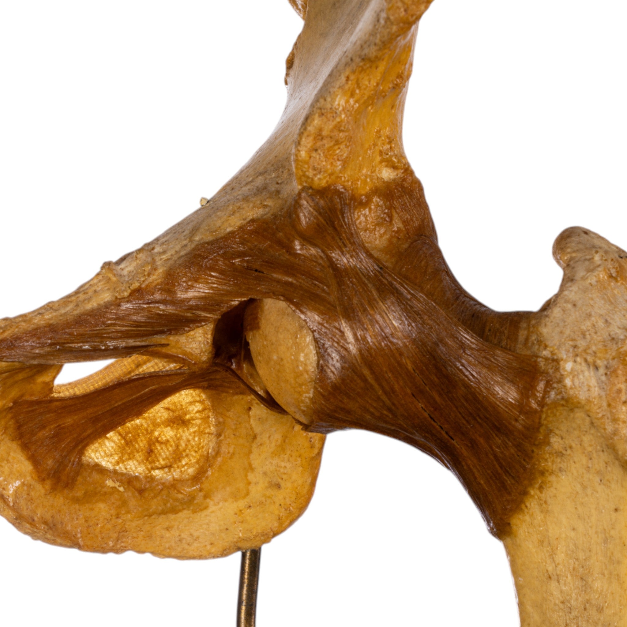 Authentic Human Left Hip Joint Specimen on Display Stand - Ideal for Medical Education, Anatomy Studies & Research