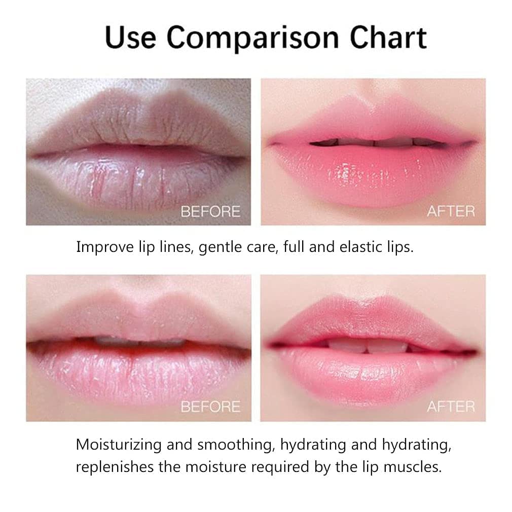 KBZONE 20 Pcs Hydrating Lip Mask - Overnight Lip Sleep Mask for Dry Lips, Reduces Lip Lines & Restores Moisture | Nourishing Gel Lip Treatment for Plumping & Softening | Perfect for Nighttime Lip Care & Daily Hydration