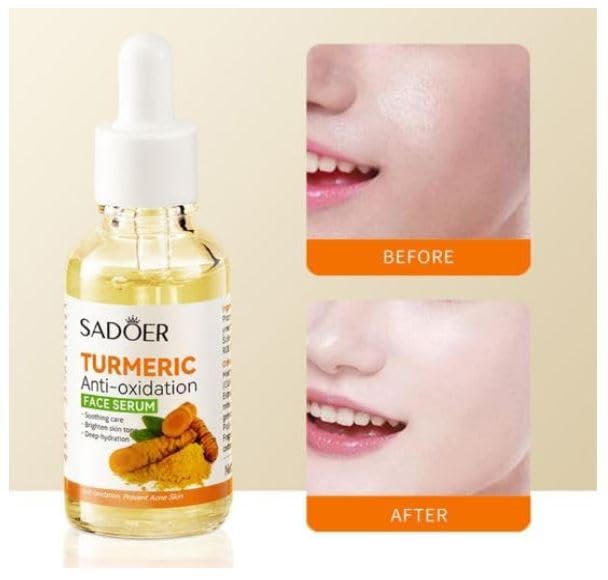 Ramley Radiant Glow Turmeric Anti-Oxidant Serum - 30ml Natural Skincare Elixir for Brightening & Anti-Aging (Pack of 2) - Perfect for Daily Face Care Routine & Nighttime Skin Repair