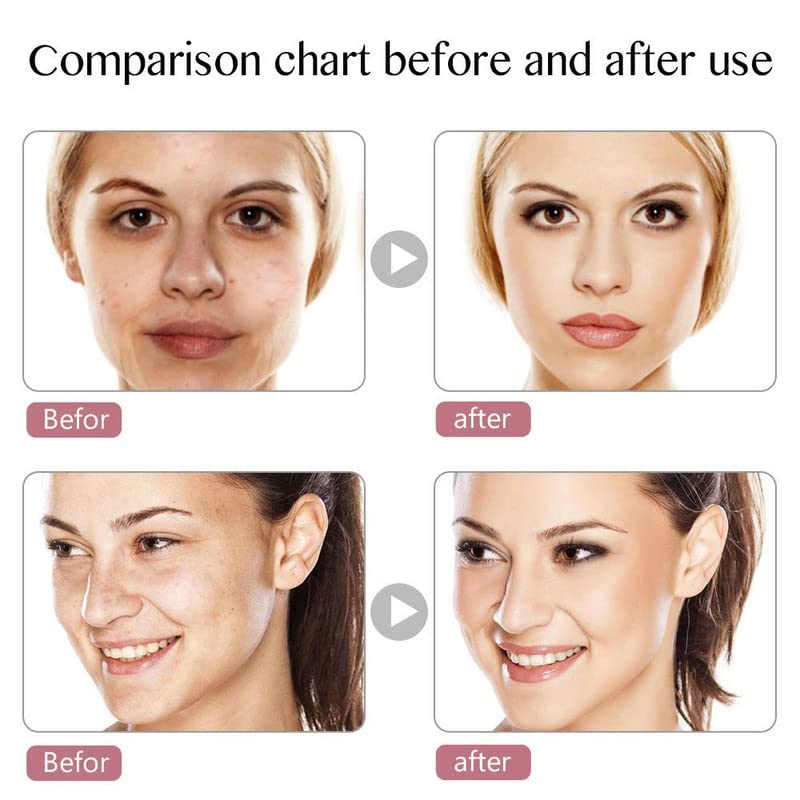 LED Light Therapy Machine for Face - Blue & Red Light Therapy Mask for Acne & Anti-Aging | At-Home Skincare Treatment for Clear Skin & Wrinkle Reduction