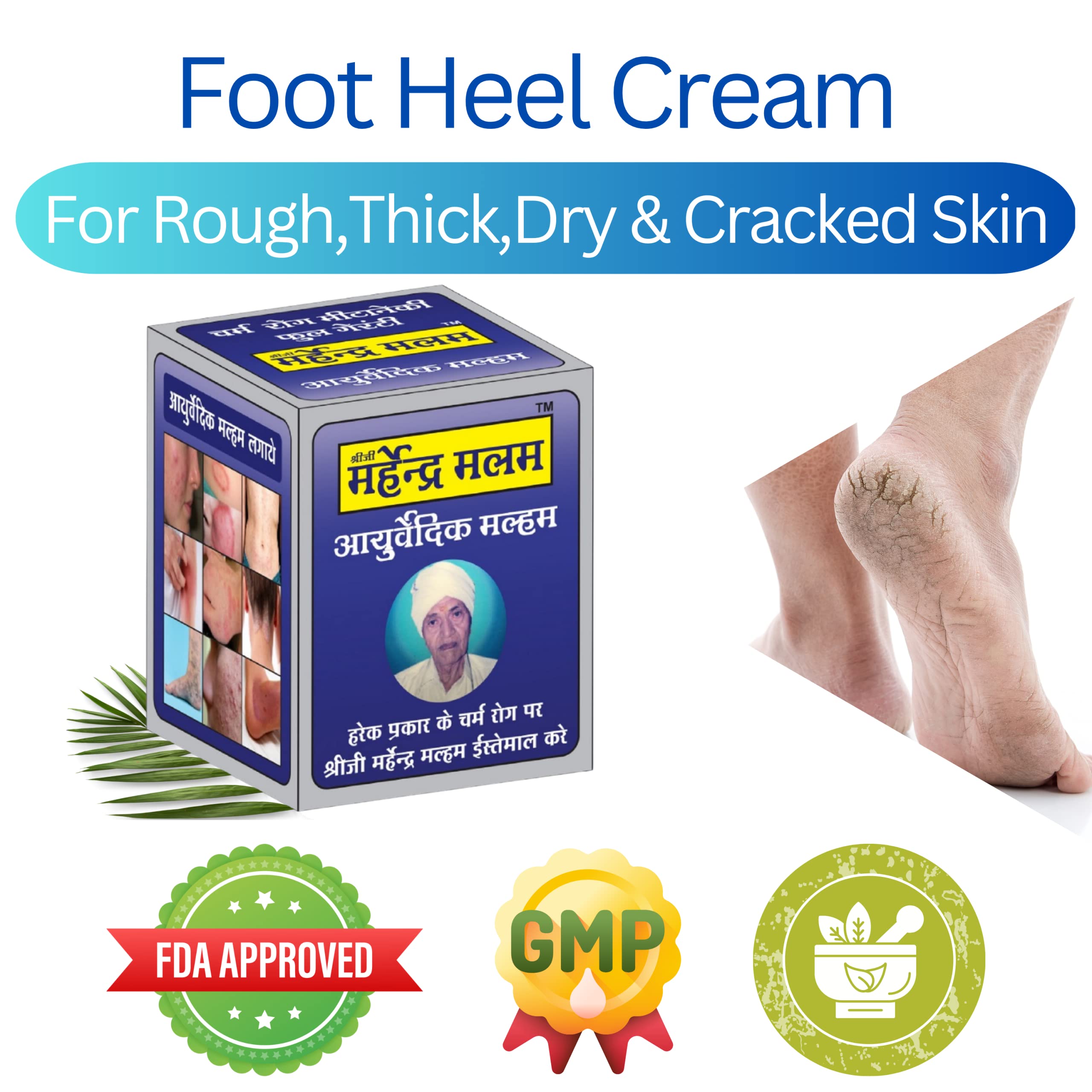 KESHBINDU Shree Ji Marhendra Ayurvedic Foot Nourishing & Allergy Relief Cream - Herbal Malam for Dry, Cracked Feet (Pack of 4) | Perfect for Diabetic Foot Care & Winter Skin Protection