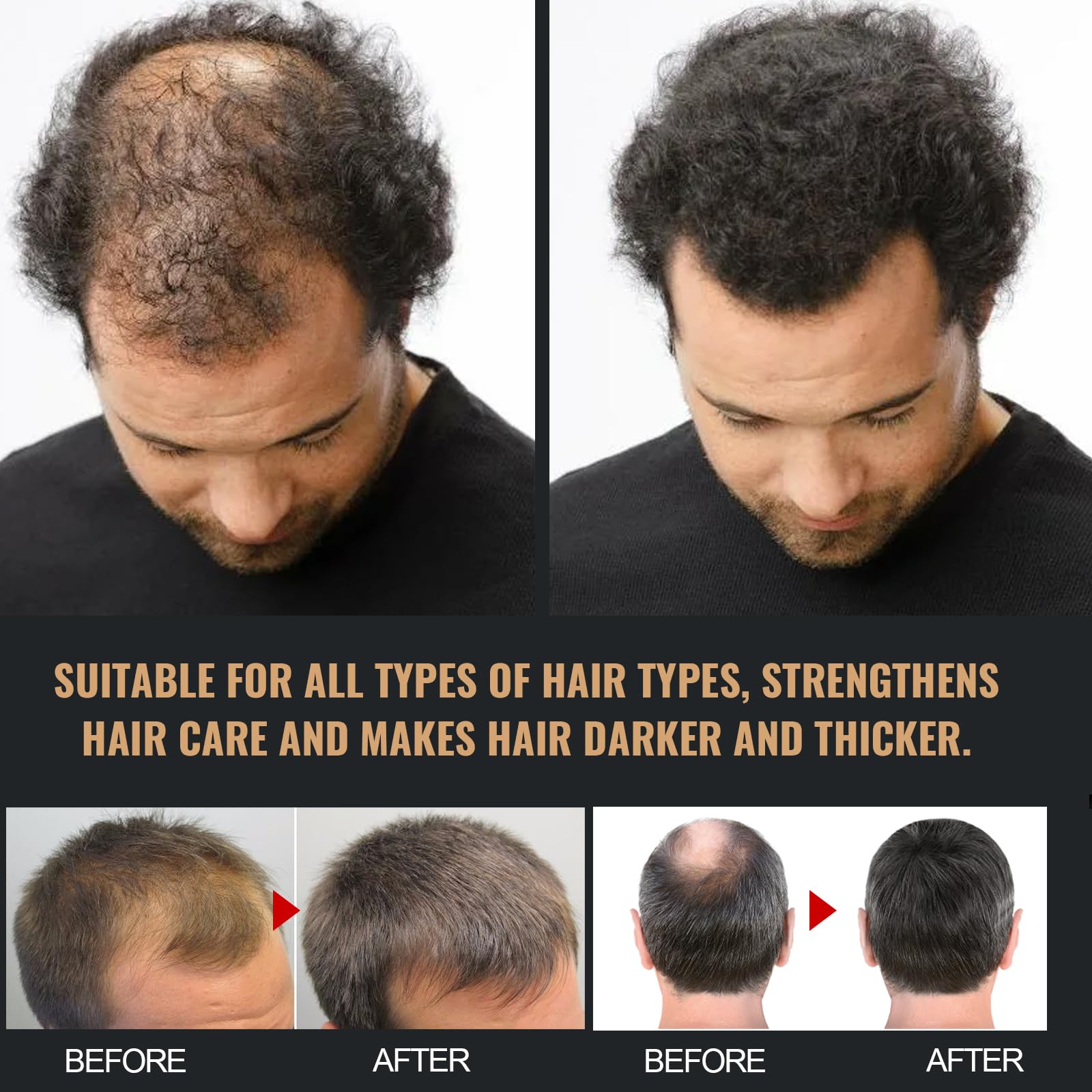 Spartan Root Activator Shampoo for Hair Regrowth - Natural Shampoo for Men & Women - 2 x 100ml Bottles - Promotes Thicker Hair & Reduces Hair Loss - Perfect for Daily Use & Scalp Care