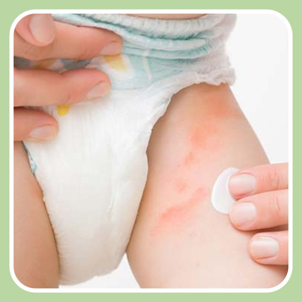 Lil’Uno NutriRich Baby & Kids Moisturizing Lotion - Dermatologist Approved 150g Hydrating Body Cream for Sensitive Skin | Gentle Daily Moisturizer for Newborns, Toddlers & Children | Perfect for Dry Skin Care After Bath & Before Bedtime
