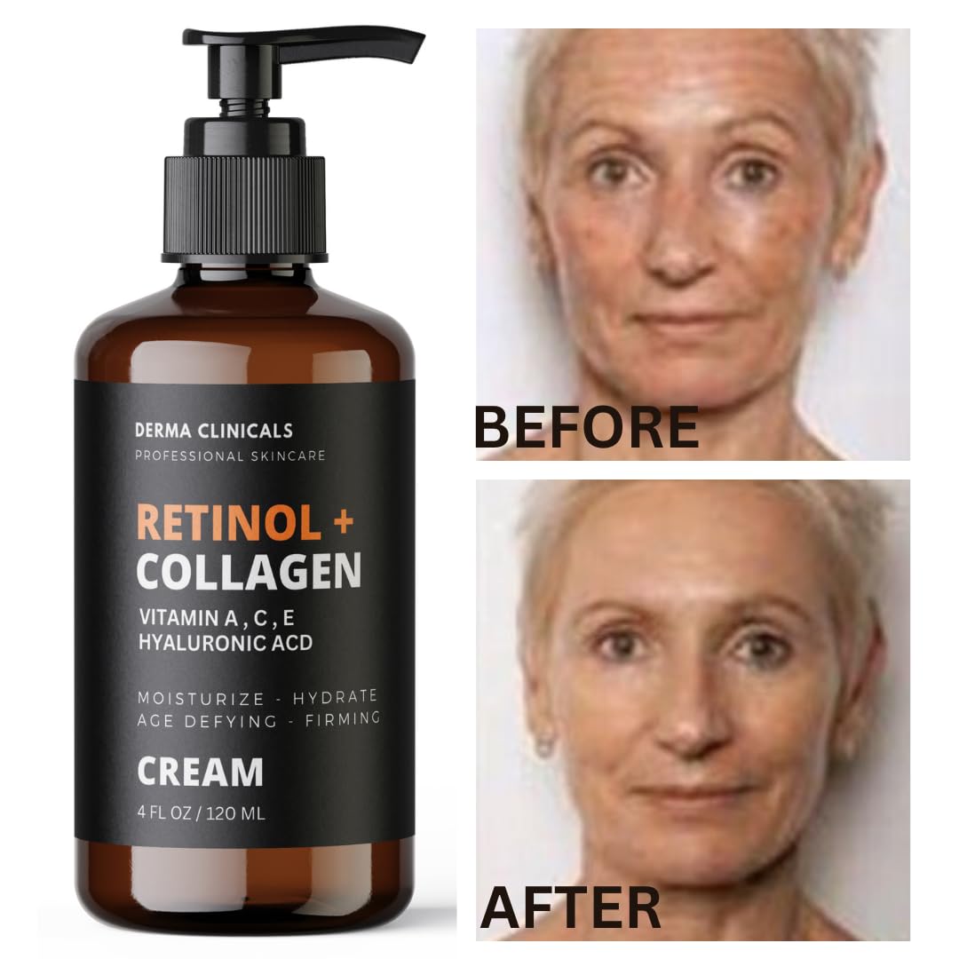 Retinol + Collagen Anti-Aging Face Cream with Hyaluronic Acid & Vitamin C - Day & Night Moisturizer for Wrinkles & Firming - 4oz - Perfect for Daily Skincare Routine & Anti-Wrinkle Treatment