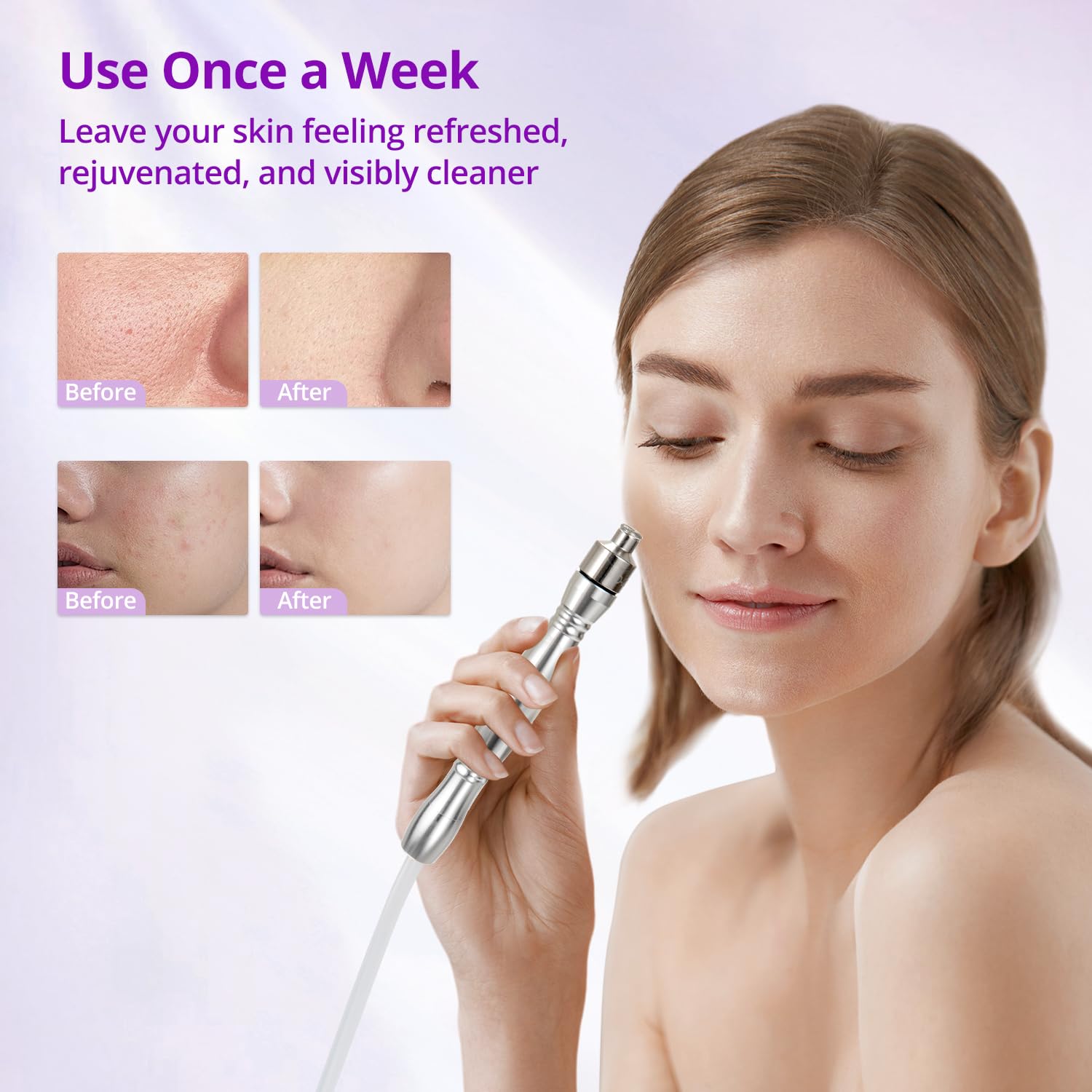 Diamond Microdermabrasion Machine - Professional Salon & SPA Skin Care Device for Face Exfoliation, Wrinkle Reduction & Skin Rejuvenation | At-Home Facial Treatment for Glowing Skin | Perfect for Acne Scars, Blackheads & Anti-Aging Routine
