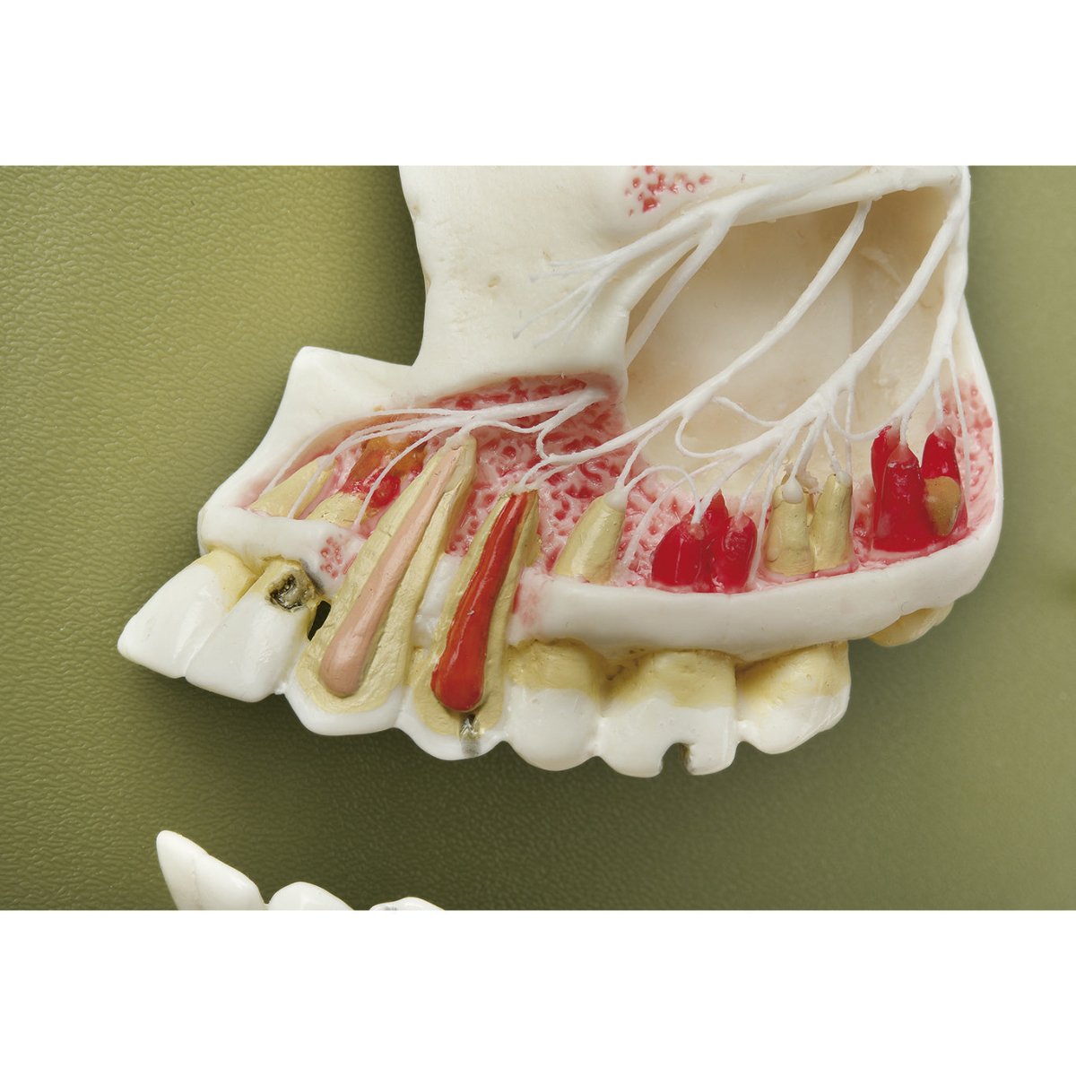 Upper and Lower Jaw Dental Model - High-Quality Dental Training Tool for Students & Professionals | Perfect for Dental Education, Practice & Demonstration