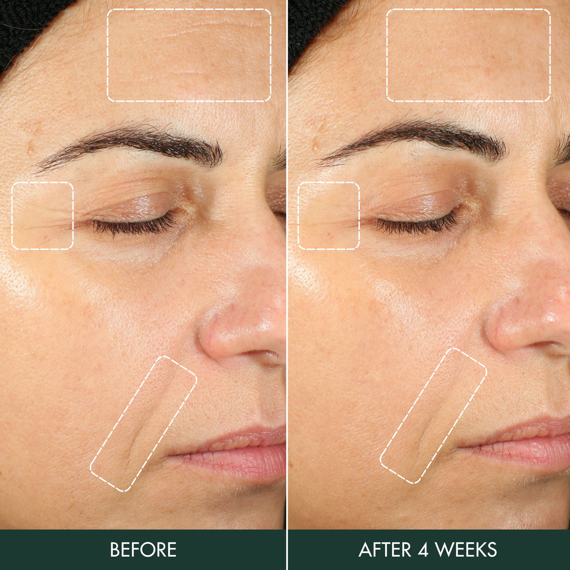 Best Hydrogel Moisturizer for Dry Skin - Hydrating Face Cream with Hyaluronic Acid - Perfect for Daily Skincare Routine & Night Care
