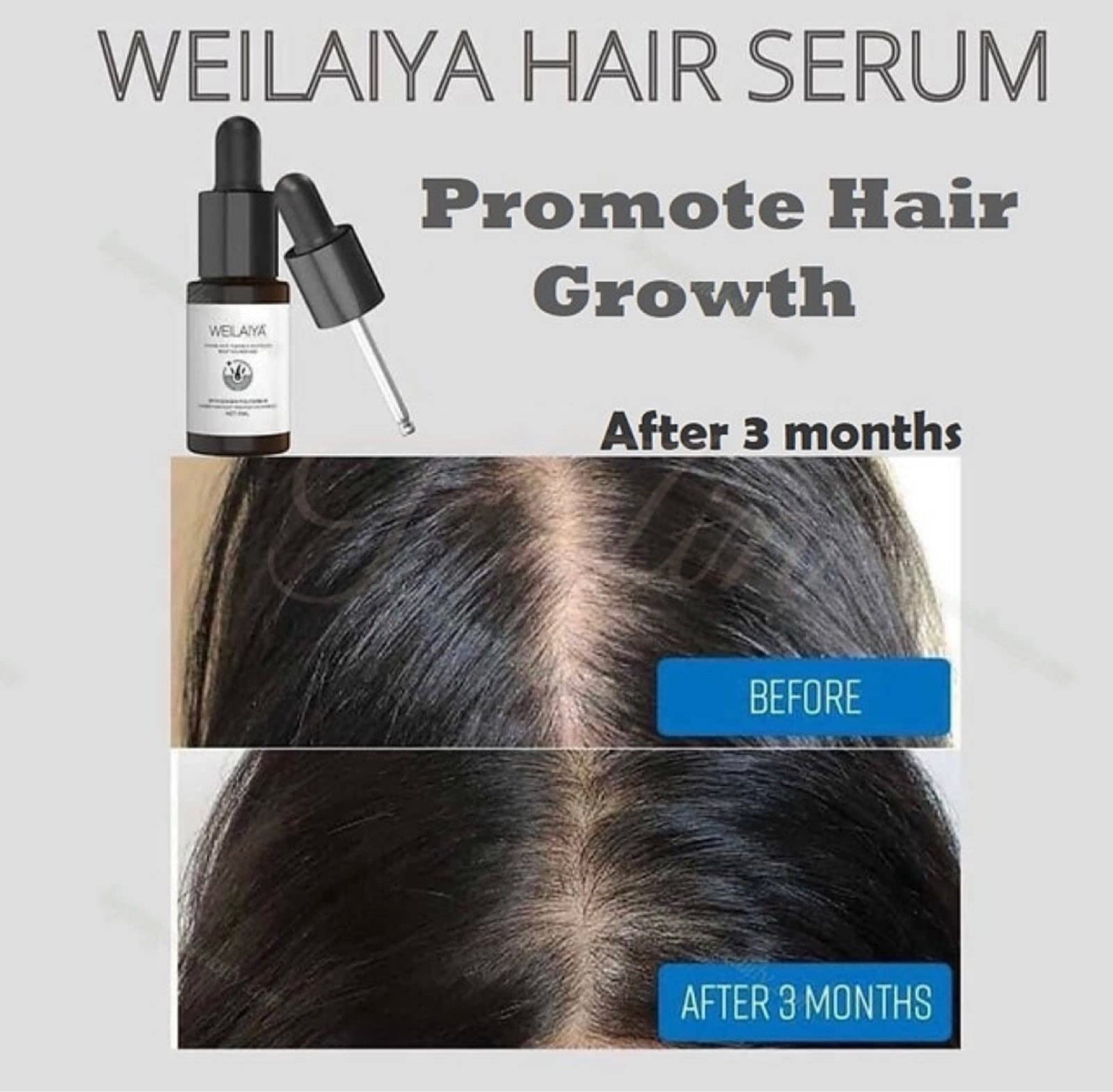 Weilaiya Ginger Shampoo & Conditioner Set with Hair Growth Serum - For Oily Hair & Scalp Care - Free Travel Bag Included (Limited Edition) - Promotes Healthy Hair Growth & Reduces Excess Oil for Daily Use