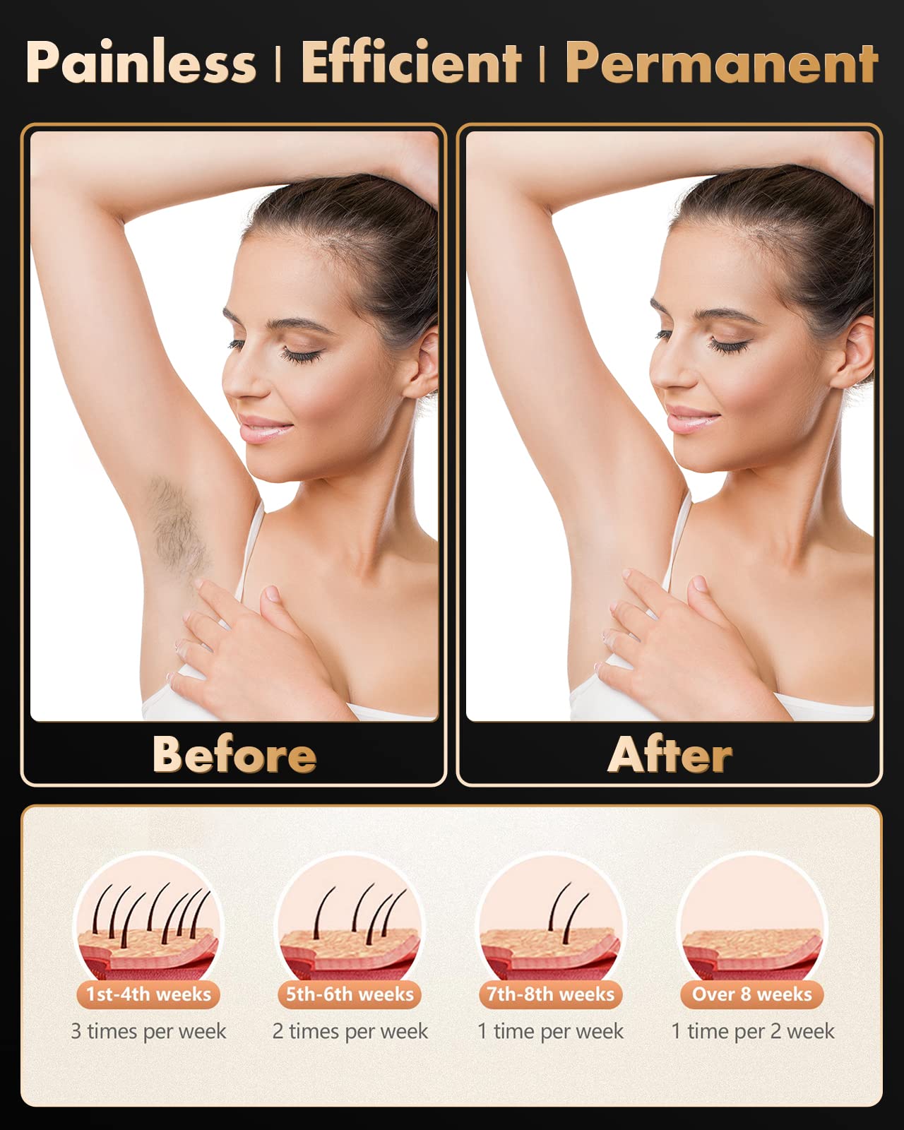 Best IPL Laser Hair Removal Device for Women & Men - Permanent Hair Removal for Face, Upper Lip, Chin, Bikini, Legs & Body - At-Home Hair Removal System for Smooth Skin | Perfect for Facial Hair, Bikini Line & Full Body Hair Removal