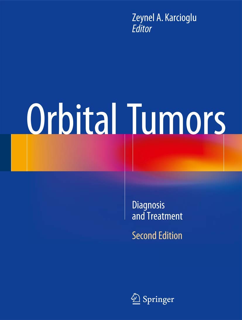 Orbital Tumors: Comprehensive Diagnosis & Treatment Guide for Eye Cancer - Essential for Ophthalmologists & Patients