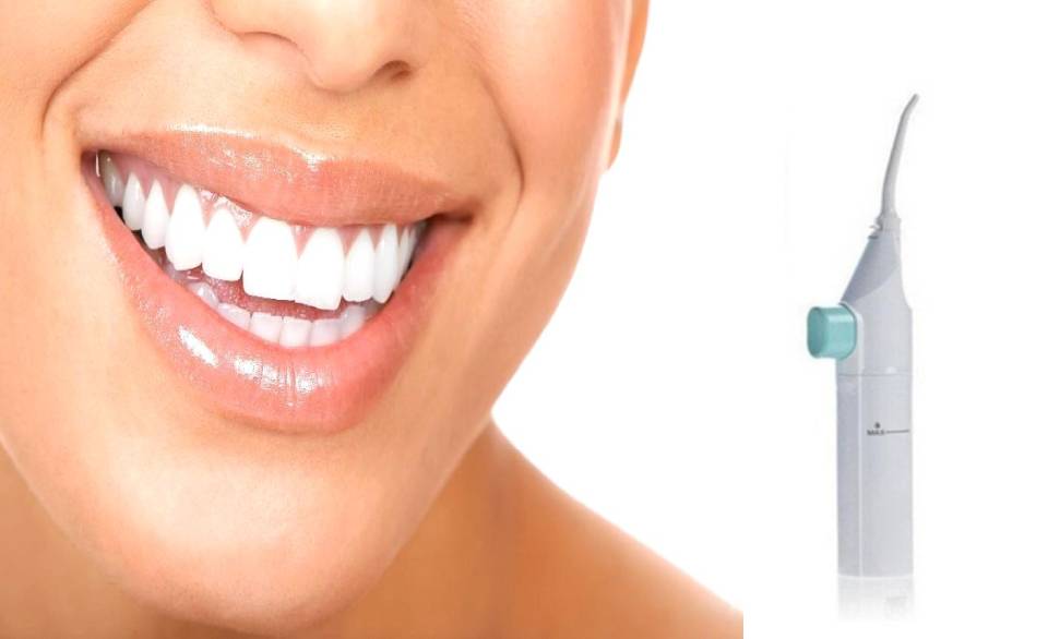 Portable Cordless Water Flosser - Rechargeable Oral Irrigator for Teeth Cleaning, Plaque Removal & Gum Care - Perfect for Travel, Braces & Dental Hygiene at Home