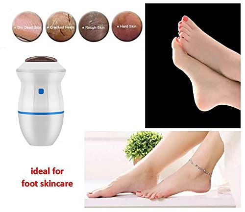 Electric Callus Remover for Feet - USB Powered Dead Skin Remover & Foot File for Hard Cracked Dry Skin - Perfect for Pedicure, At-Home Foot Care & Soft Smooth Heels