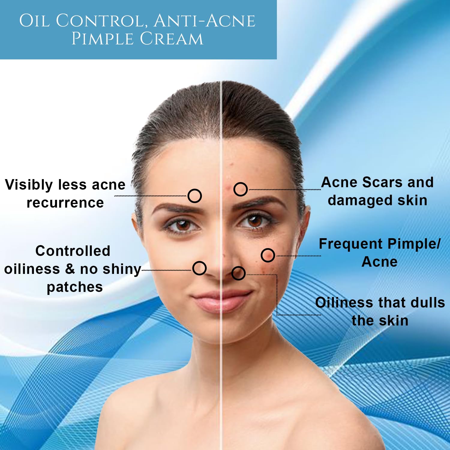 Khadi Organic Oil Control Anti Acne Pimple Cream - Natural Solution for Clear, Blemish-Free Skin - 50g | Best for Oily & Acne-Prone Skin | Daily Skincare Routine for Teens & Adults