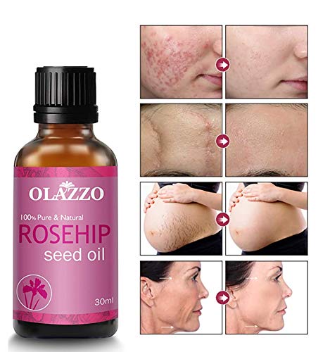 OLAZZO Organic Rosehip Face Oil for Glowing Skin - Reduces Wrinkles & Fine Lines, Dark Circles Treatment, Promotes Hair Growth for Curly Hair (30ml) | Perfect for Night Routine, Dry Skin Care & Natural Hair Hydration
