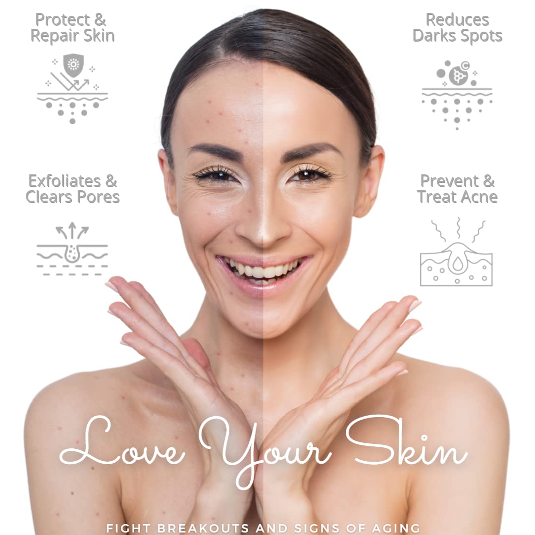 2% Salicylic Acid Serum for Acne Treatment - Exfoliating Face Serum for Smooth & Bright Skin - Vegan & Cruelty-Free Skincare (30ml) - Perfect for Daily Acne-Prone Skin Care Routine