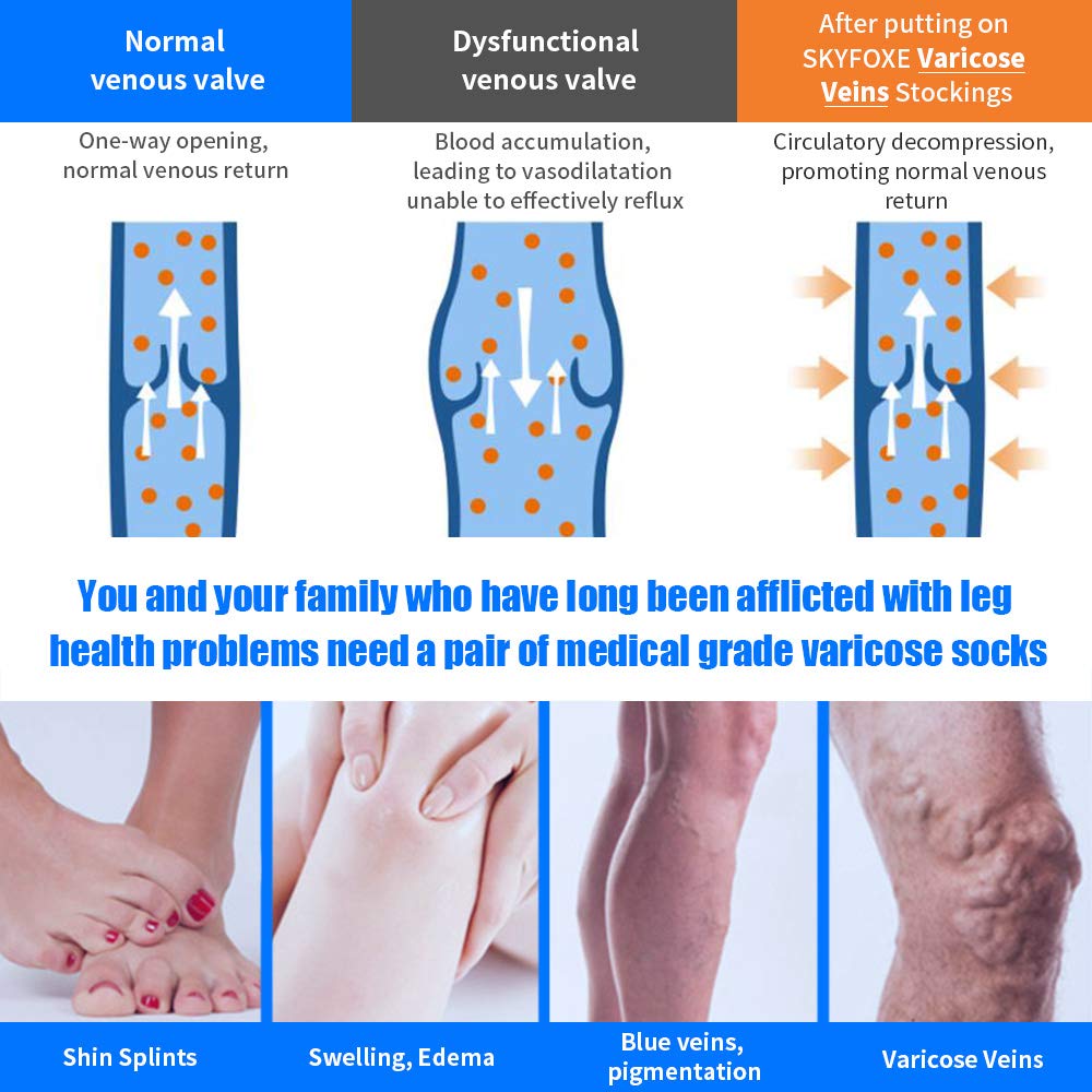 20-30mmHg Thigh High Compression Stockings for Women & Men - Firm Graduated Support Opaque Medical Socks for Varicose Veins, Circulation & Travel - Perfect for Nurses, Athletes & Long Flights