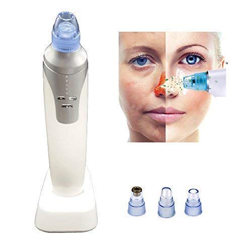 Nirva Electric Blackhead Remover Vacuum Pore Cleaner - Professional Skin Care Tool for Face, Nose & Body - Perfect for Deep Cleansing & Acne Treatment at Home