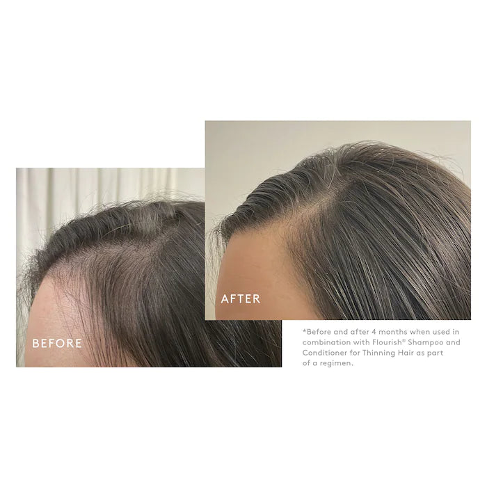 Virtue Flourish Density Booster for Hair Growth & Thickening - Volumizing Treatment for Thin Hair | Perfect for Daily Use & Styling