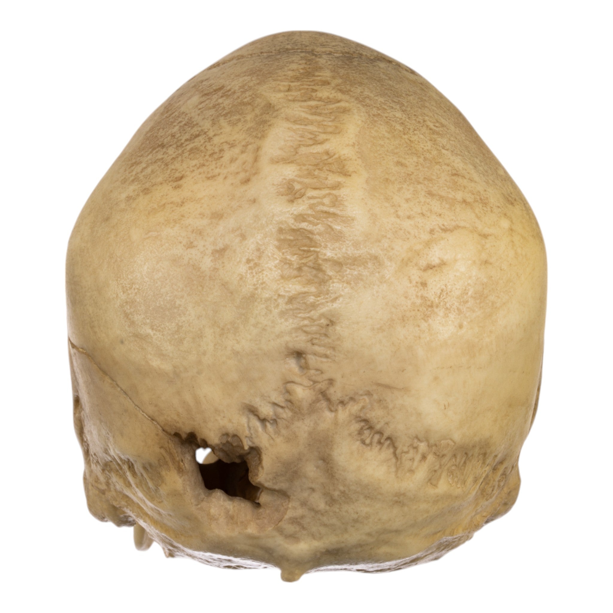 Realistic Replica Human Male Skull with 32 Caliber Gunshot Wound - Perfect for Medical Training, Forensic Studies, and Halloween Decorations