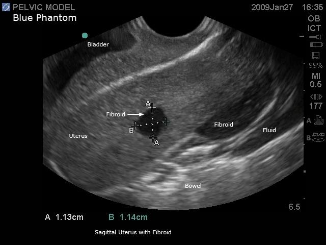 General Pathology Transvaginal Ultrasound Training Model - High-Quality Medical Simulation for OB/GYN Education & Clinical Practice - Perfect for Medical Schools, Hospitals & Diagnostic Labs