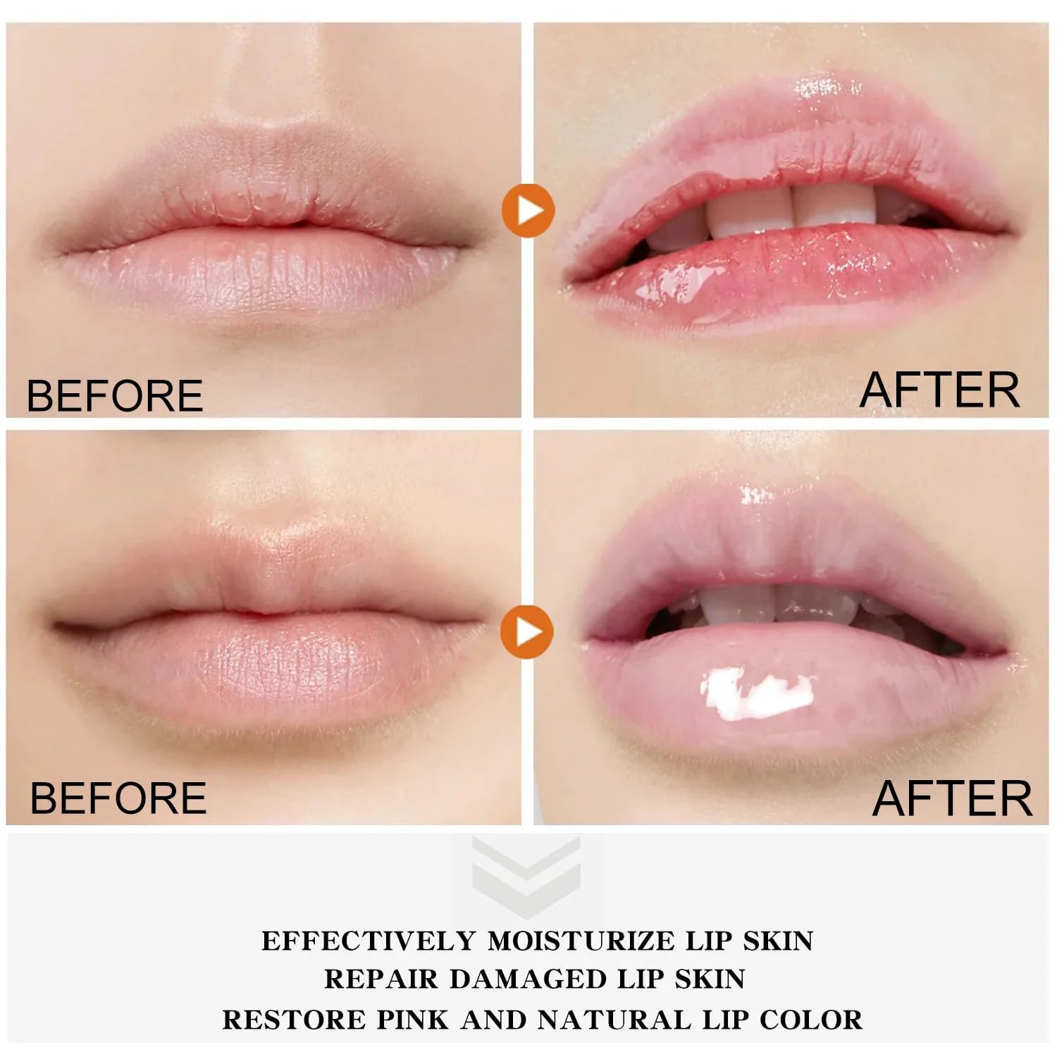 MEXMOB Turmeric Lip Balm - Dark Spot Remover, Whitening & Moisturizing Lip Treatment with Hyaluronic Acid - Exfoliates Dead Skin, Lightens Lips - Perfect for Dry, Chapped Lips & Night Lip Care Routine