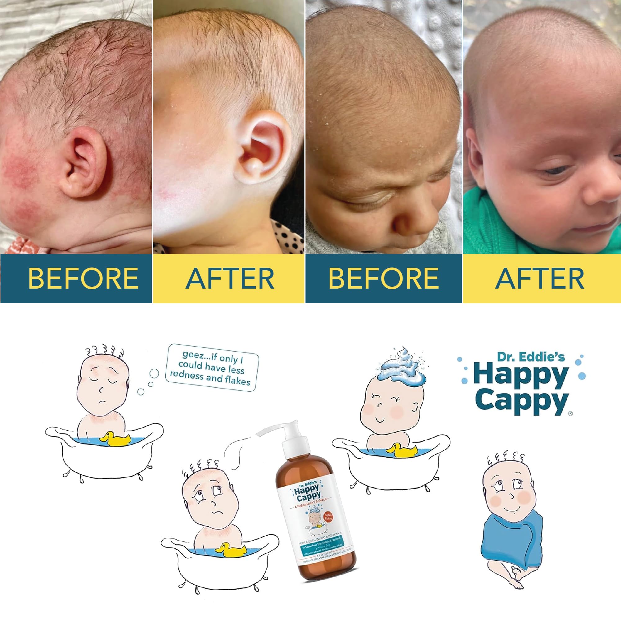 Happy Cappy Dr. Eddie’s Medicated Shampoo & Body Wash for Babies - Cradle Cap & Seborrheic Dermatitis Treatment, Reduces Redness & Flakes, Fragrance-Free, Dermatologist Tested - 8 Fl Oz (Pack of 2) - Gentle Daily Wash for Newborns & Sensitive Skin