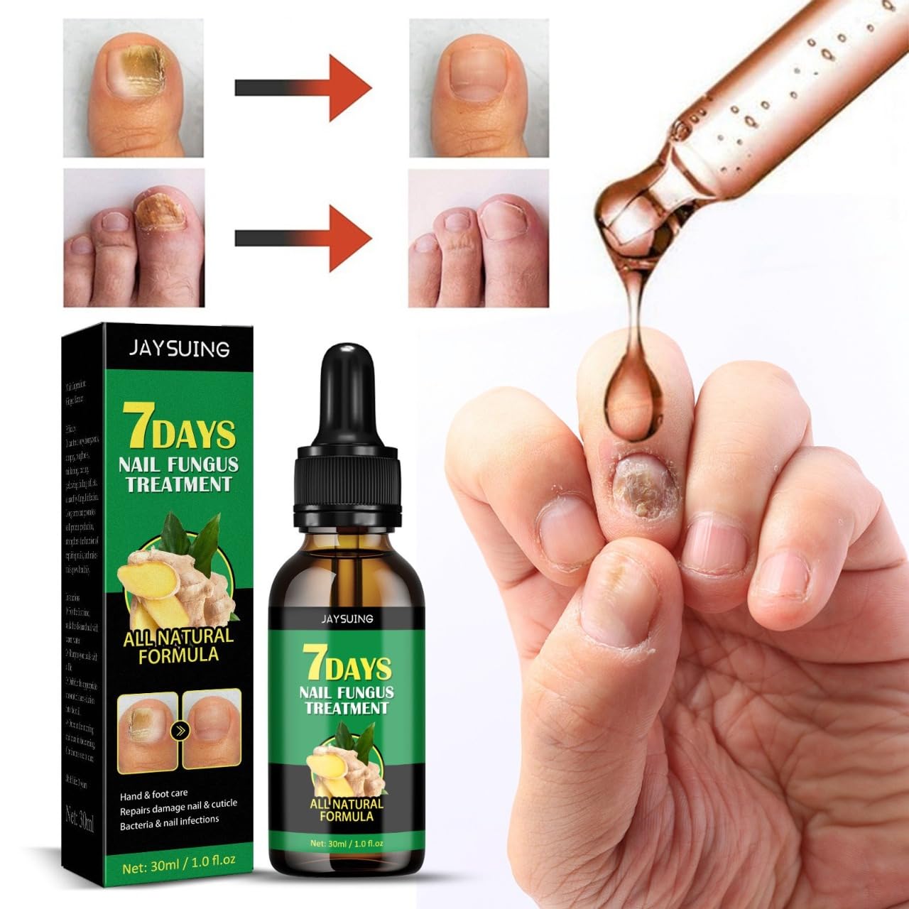 7-Day Ginger Nail Serum & Cuticle Care Oil - Natural Nail Treatment for Stronger Nails | Ginger Nail Support & Repair | Perfect for Dry, Brittle Nails & Cuticle Care | At-Home Manicures & Nail Spa Treatments