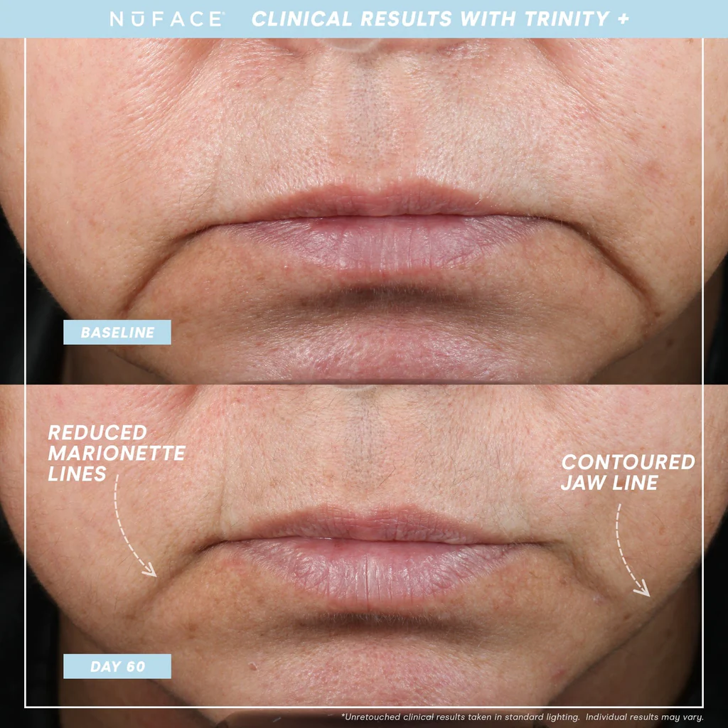 NuFACE Trinity+ Facial Toning Device with Lip & Eye Attachment - Anti-Aging Microcurrent Therapy for Wrinkles & Fine Lines | Perfect for Home Skincare & Professional Use