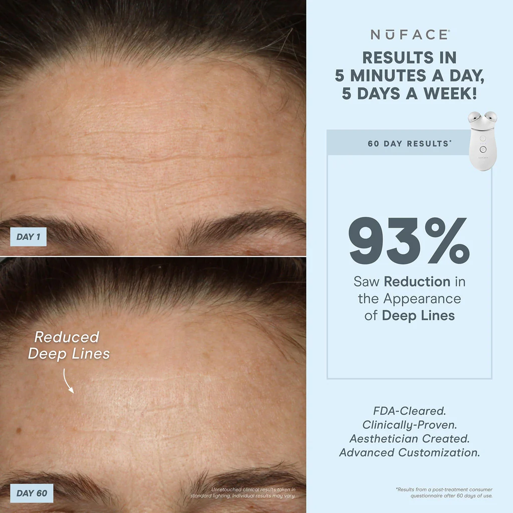 NuFACE TRINITY+ Facial Toning Device with Wrinkle Reducer Attachment - At-Home Microcurrent Skincare for Lifting & Anti-Aging | Perfect for Daily Use & Professional Results