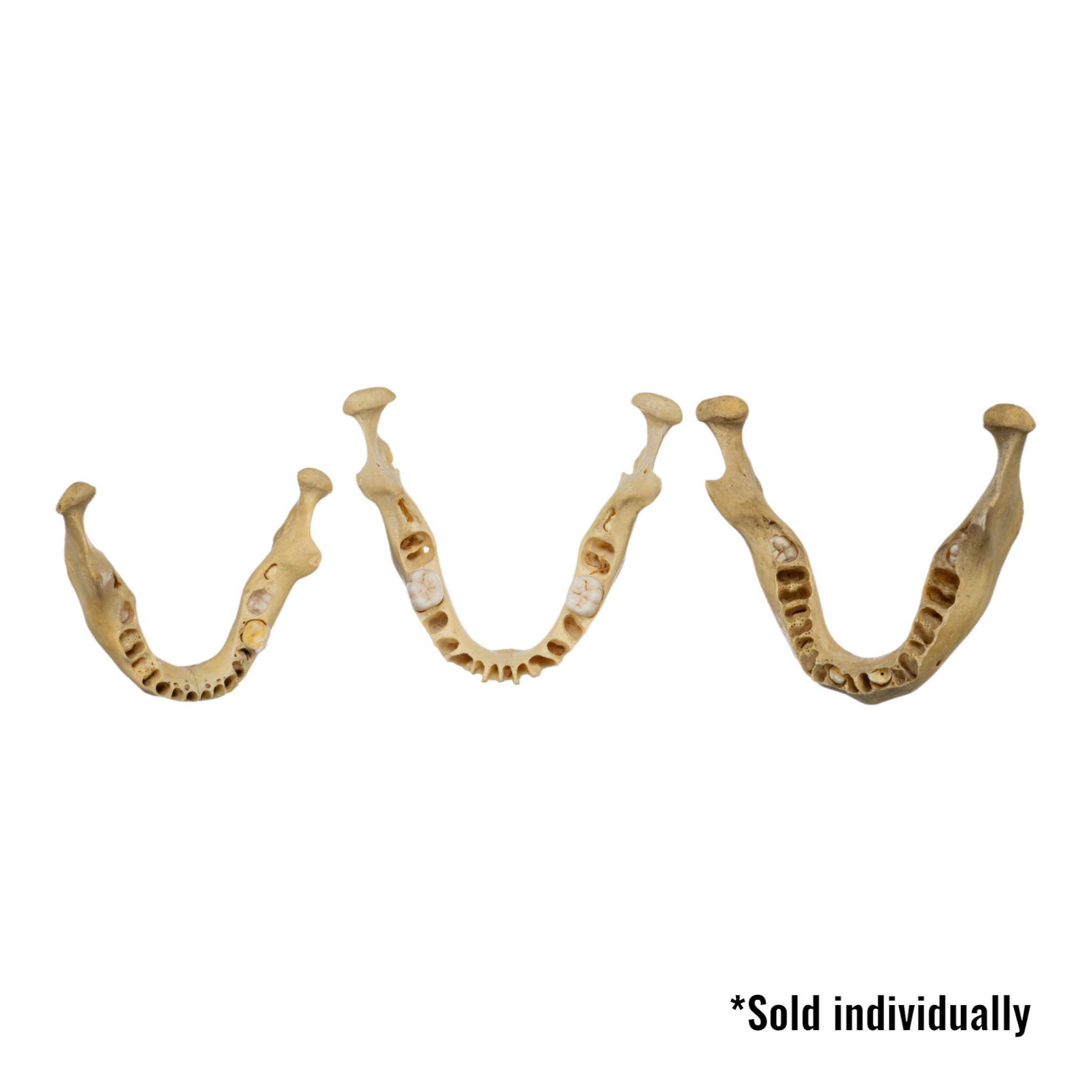 Authentic Real Human Mandible Bone - Young Adult Single Jawbone Specimen for Medical Study, Anatomy Education & Forensic Research