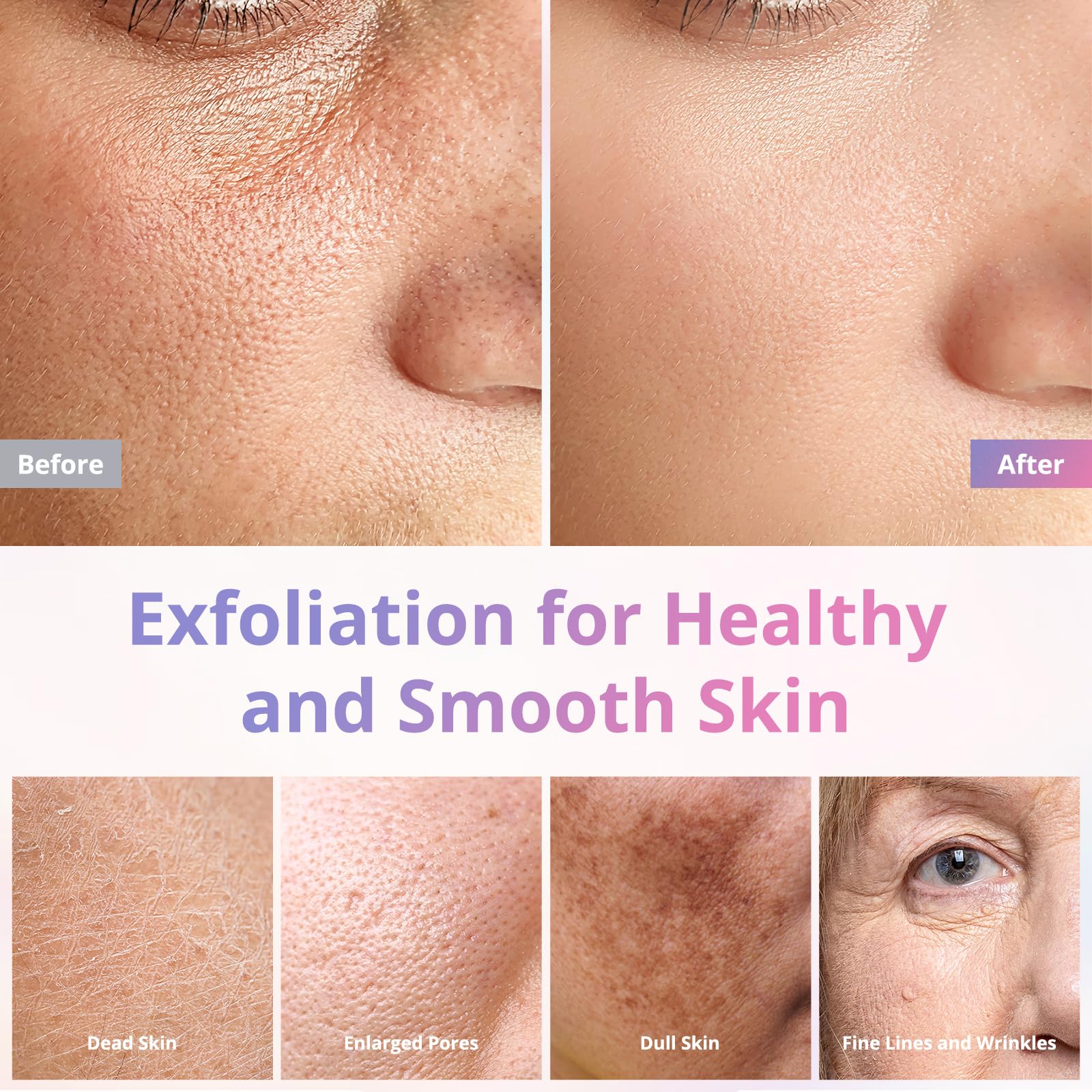 Professional Diamond Microdermabrasion Machine for Face & Body - Salon & Home Use Skin Exfoliation Device - At-Home Spa Treatment for Glowing Skin