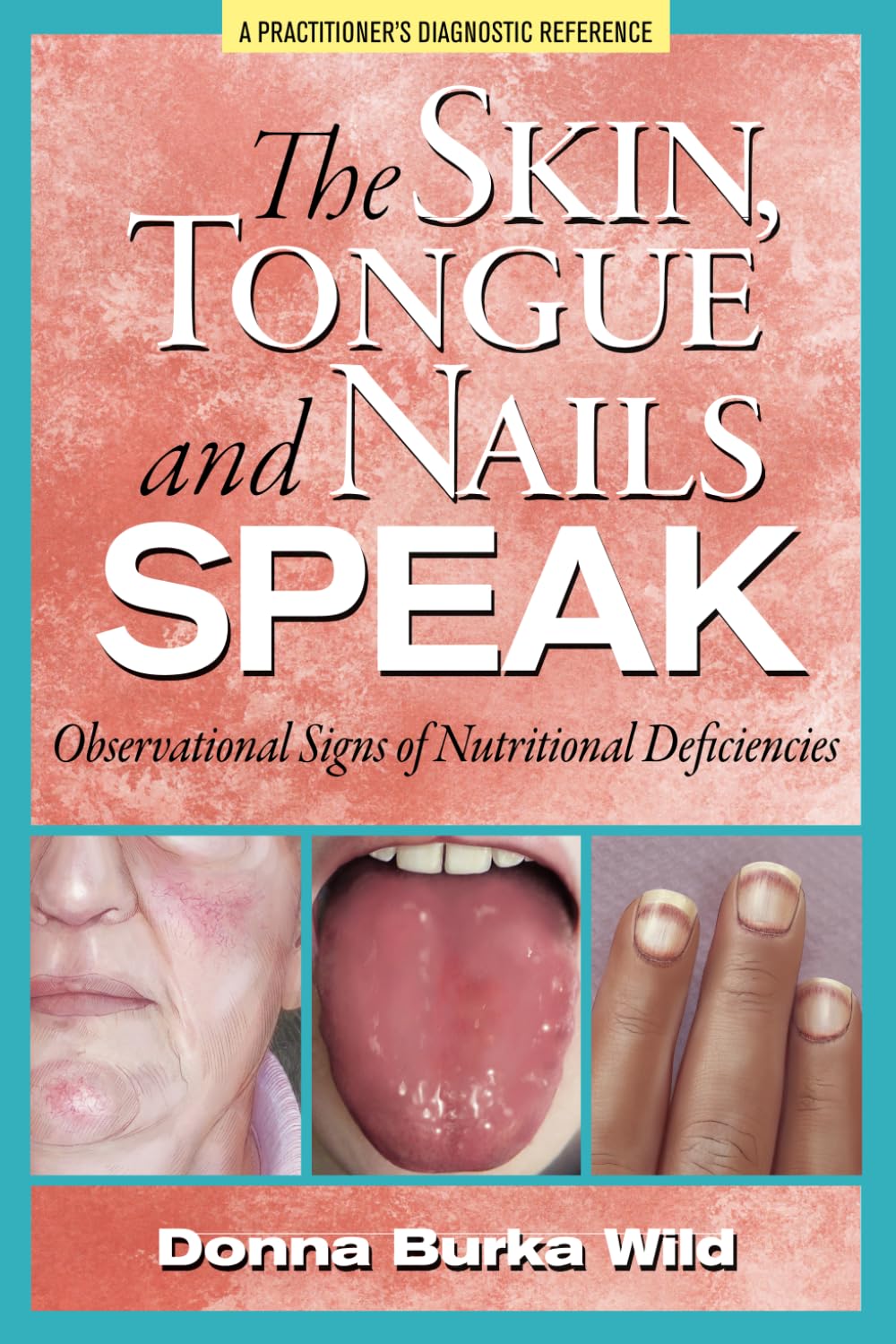Skin, Tongue & Nail Signs of Nutritional Deficiencies - How to Spot Vitamin & Mineral Deficits | For Health Monitoring & Wellness Checks