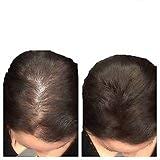 Stylazo Hair Building Fiber Volumizer for Thinning Hair - 25g Dark Brown | Instant Hair Thickening & Coverage Solution for Men & Women - Perfect for Daily Use & Special Occasions